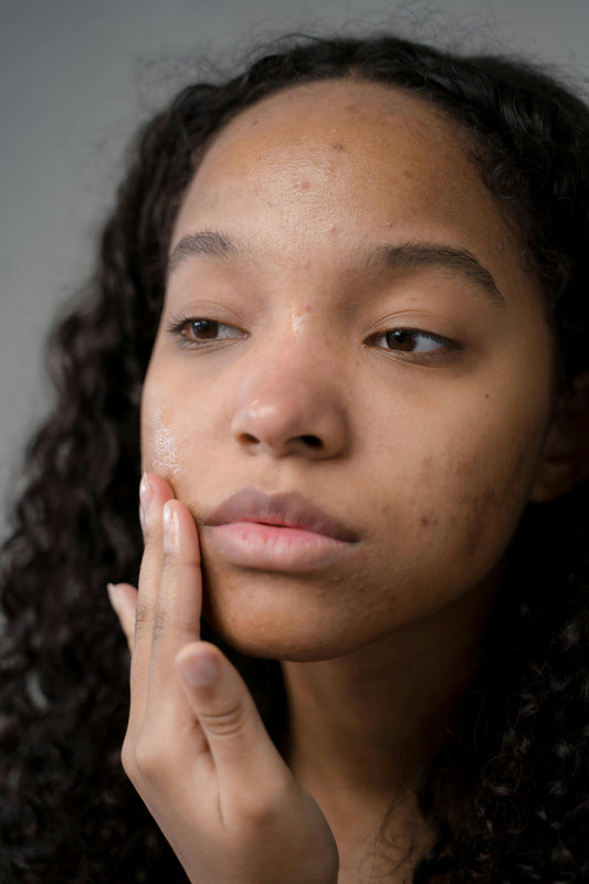 CLEAR SKIN STARTS WITH SMALL CHANGES—HERE’S WHERE TO BEGIN